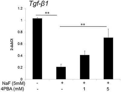 4-phenylbutyrate Mitigates Fluoride-Induced Cytotoxicity in ALC Cells